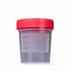 Urinsammelbehälter mit rotem Schnappdeckel